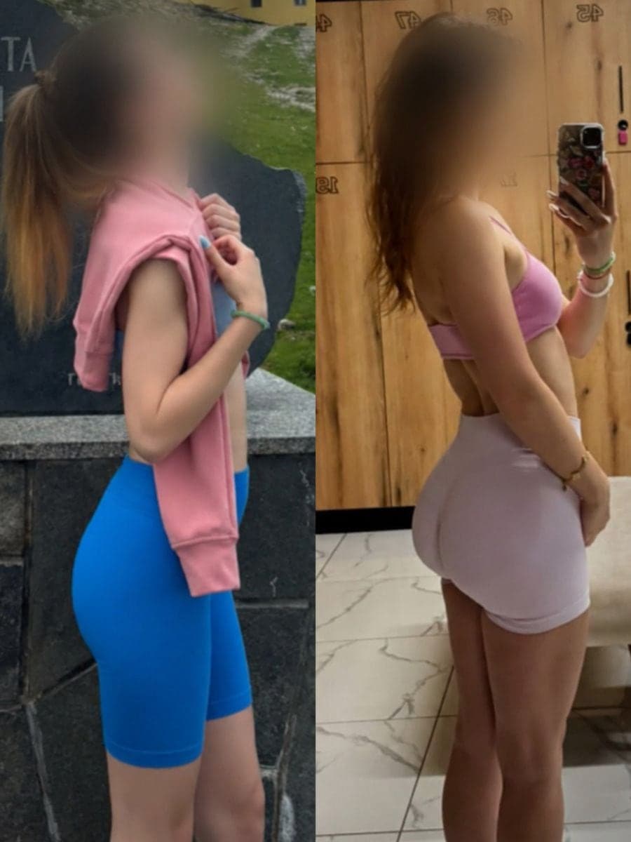 Ивета, 23 г., преди и след, в профил